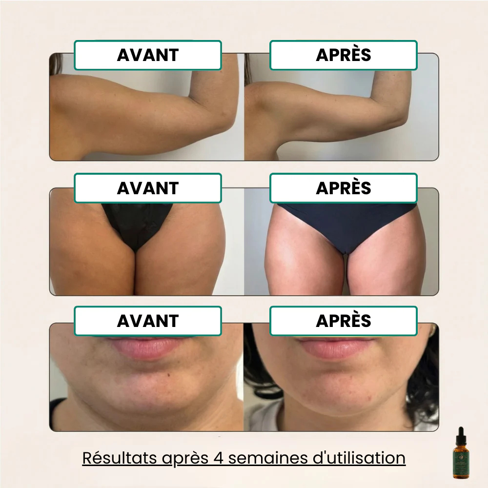 DRAINANT LYMPHATIQUE